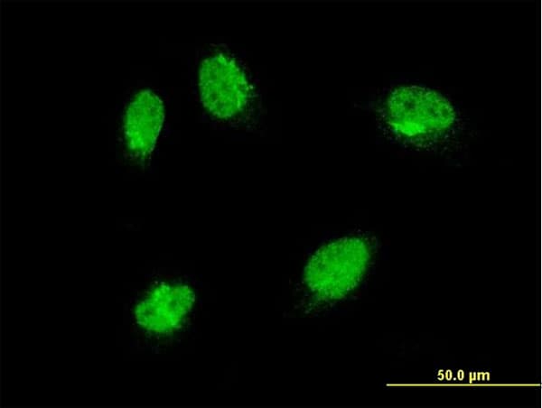 MAPK6 / ERK3 Antibody (clone 1G6)