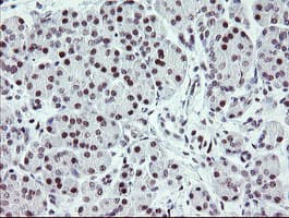 ZBED1 / TRAMP Antibody (clone OTI2A7)