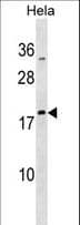 Polyclonal Rabbit anti-Human MRPL48 Antibody (aa31-59, WB)