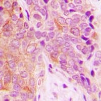 OTUB1 / OTU1 Antibody