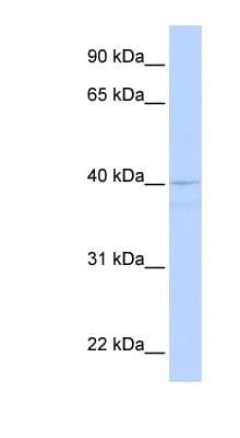 Polyclonal Rabbit anti-Human CREB3 / LZIP Antibody (aa180-229, WB)