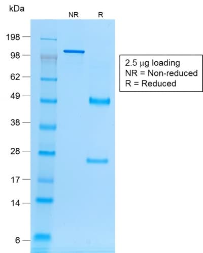 Recombinant Monoclonal Mouse anti-Human EPCAM Antibody (clone rVU-1D9, Azide-free,Carrier-free, IHC)