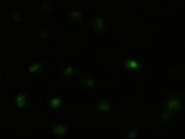Monoclonal Mouse anti-Human MAPK8 / JNK1 Antibody (clone OTI4E3, IF, WB)