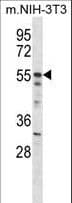IHC-plus™ AKT2 Antibody (aa93-122)