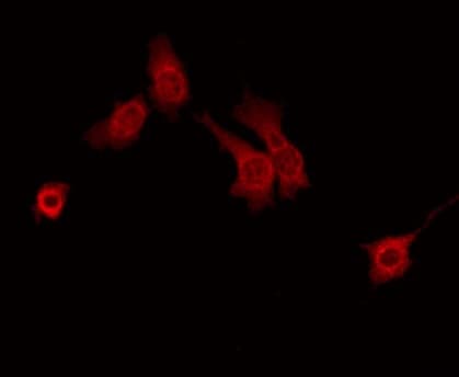 PTGR1 / LTB4DH Antibody