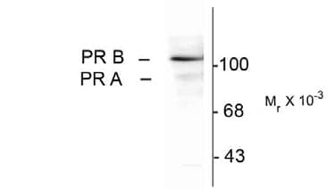 PR / Progesterone Receptor Antibody (phospho-Ser294)