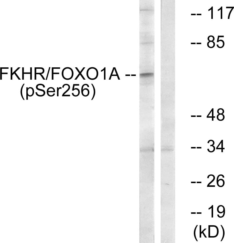 Polyclonal Rabbit anti-Human FOXO1 / FKHR Antibody (phospho-Ser256, IHC, WB)