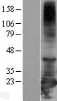 RBBP9 Protein (Over-Expression Lysate Myc-DDK (Flag))