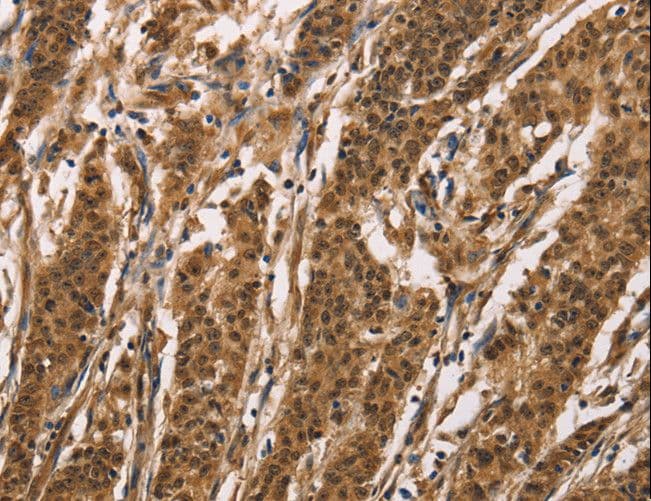 ADGRB1 / BAI1 Antibody