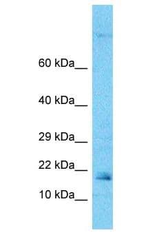 ARF6 Antibody (aa125-174)