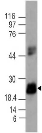 IL17C Antibody