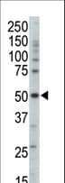 PRKAG3 / AMPK Gamma 3 Antibody (aa148-178)