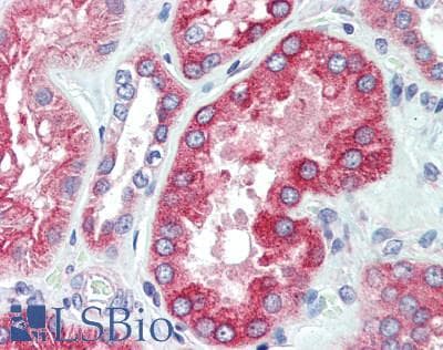 IHC-plus™ SLC39A4 / ZIP4 Antibody