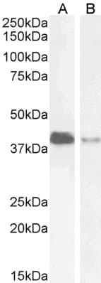 IHC-plus™ Polyclonal Goat anti-Human PARD6A / PAR6 Antibody (aa334-346, IHC, WB)