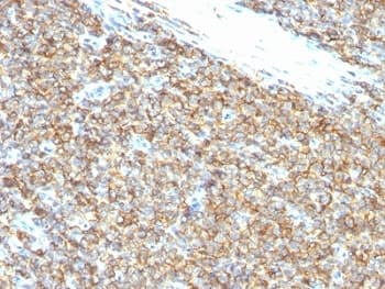 CD99 Antibody (clone 12E7.)