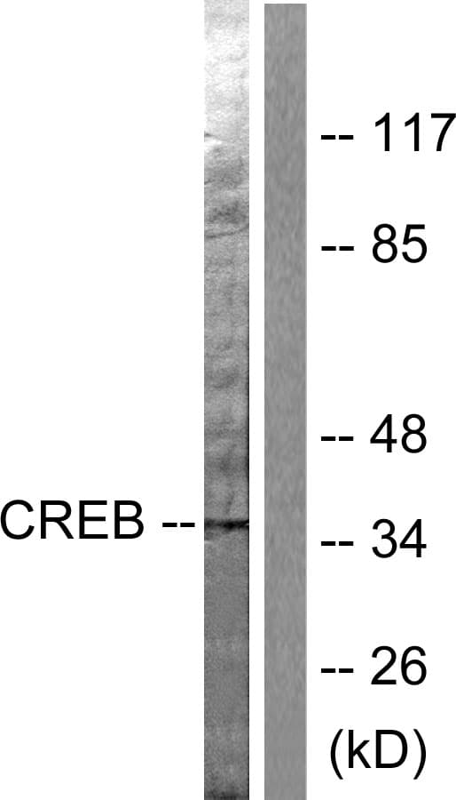 CREB1 / CREB Antibody (aa111-160)