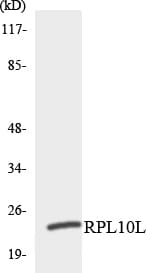RPL10L Antibody (aa145-194)