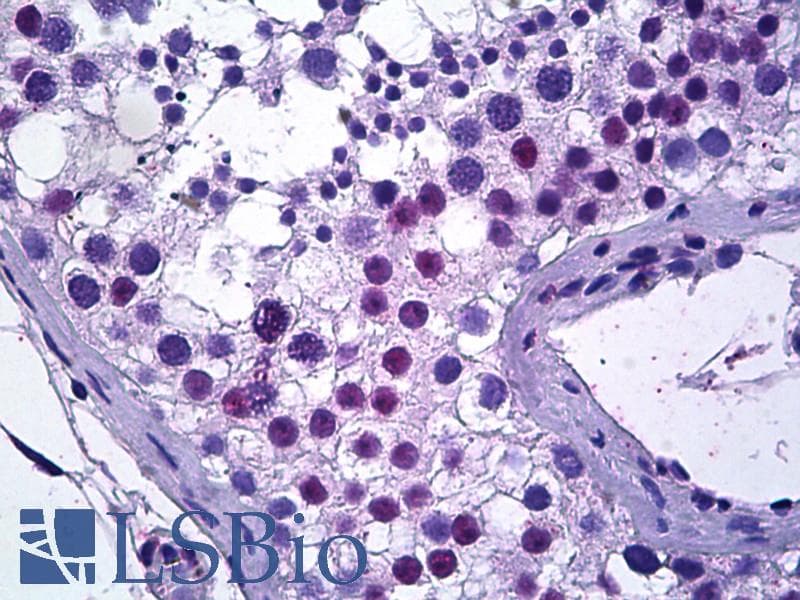 IHC-plus™ TSPYL2 / DENTT Antibody (aa680-693)