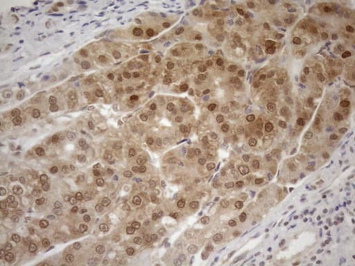 MGMT Antibody (clone OTI6C4)