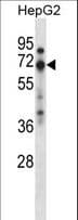 Polyclonal Rabbit anti-Human ZNF395 Antibody (aa293-322, WB)