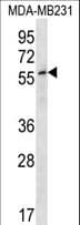 ZNF506 Antibody (aa145-174)