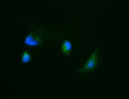 CA12 / Carbonic Anhydrase XII Antibody (clone OTI4D1)