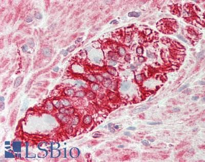 KLHL25 Antibody (aa144-193)