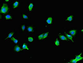 Polyclonal Rabbit anti-Human USE1 / p31 Antibody (IF, WB)