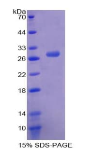 Human MNDA Protein (Recombinant His-T7)