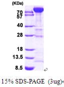 Human PFKM / PFK-1 Protein (Recombinant His)