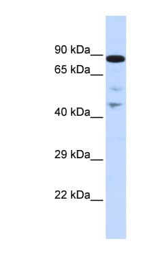 RAD54L Antibody (aa216-265)