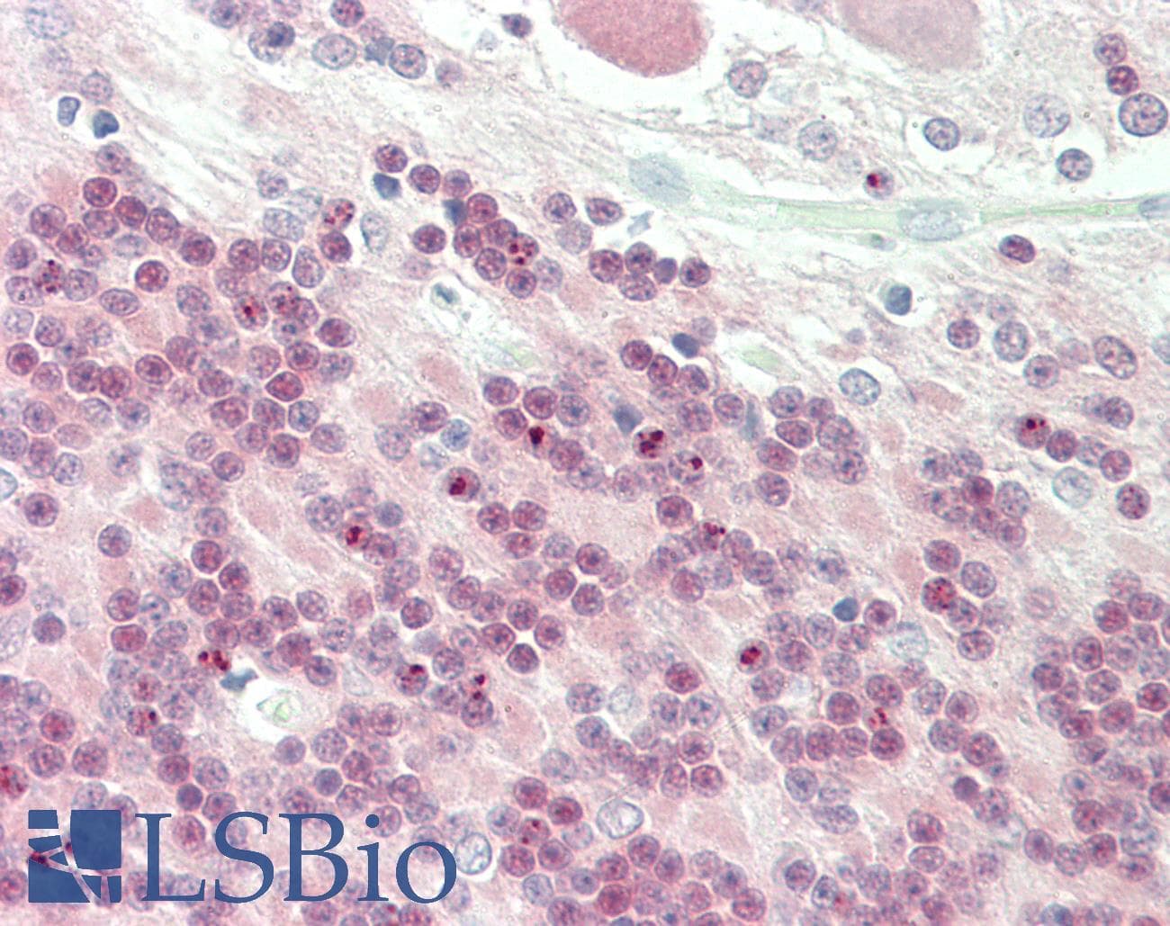 IHC-plus™ Monoclonal Rabbit anti-Human CRTC1 / MECT1 / TORC1 Antibody (IHC, WB)
