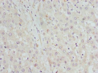 GBE1 Antibody