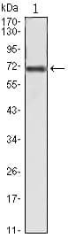 FAK / Focal Adhesion Kinase Antibody (clone 10H7E9)