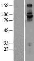 ITGB7 / Integrin Beta 7 Protein (Over-Expression Lysate Myc-DDK (Flag))