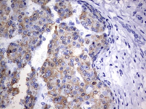 Monoclonal Mouse anti-Human OTC Antibody (clone OTI5F4, aa33-354, IHC, WB)