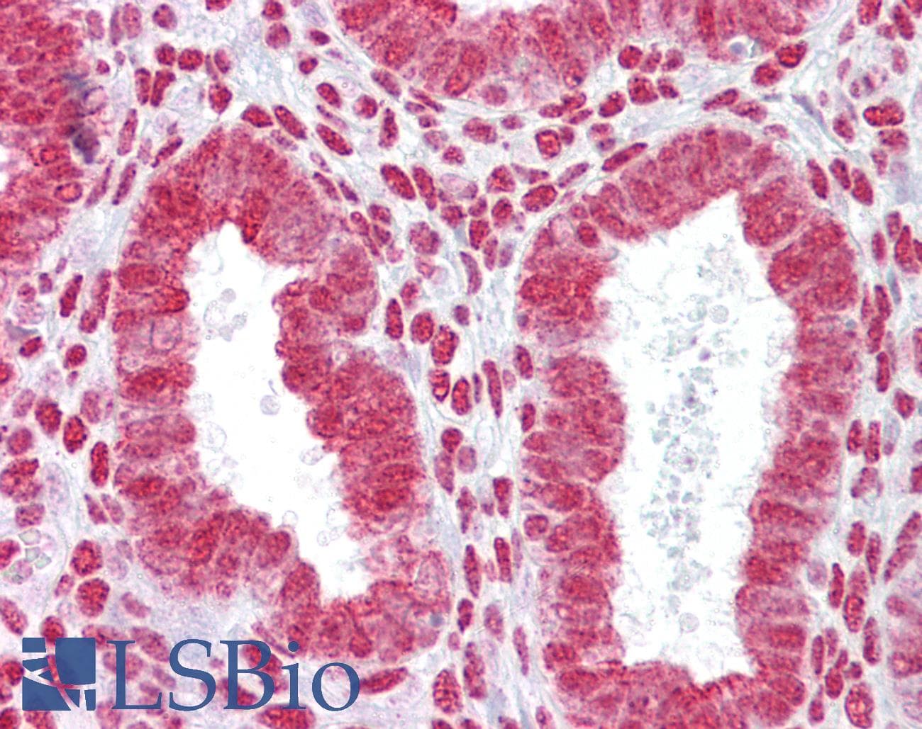 Polyclonal Rabbit anti-Mouse HOXA11 Antibody (aa210-259, IHC, WB)