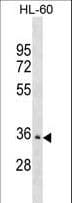 Polyclonal Rabbit anti-Human PDLIM3 Antibody (aa329-355, WB)