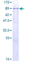 Human ARSF / Arylsulfatase F Protein (Recombinant GST)