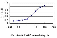 IHC-plus™ CLDN1 / Claudin 1 Antibody (clone 1C5-D9)