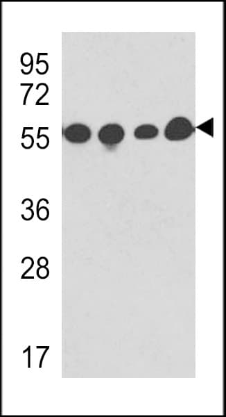 PathPlus™ TUBB / Beta Tubulin Antibody