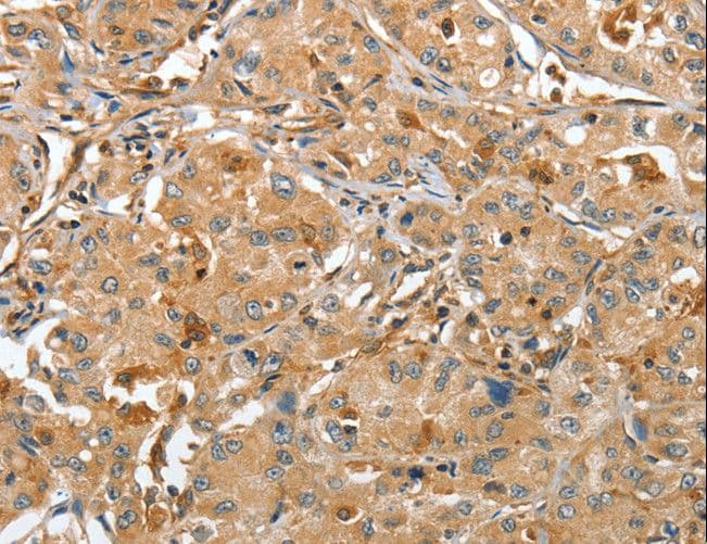 Polyclonal Rabbit anti-Human RAP1A Antibody (IHC)
