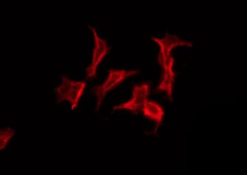 ABHD12 Antibody