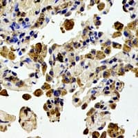 STMN1 / Stathmin / LAG Antibody (N-Terminus)