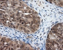 PTPRE / PTP Epsilon Antibody (clone OTI3H8)