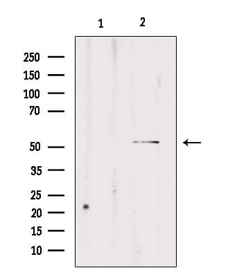 CPE / Carboxypeptidase E Antibody