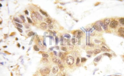 SMAD1 Antibody