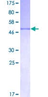 Human TNNI3 / Cardiac Troponin I Protein (Recombinant GST)