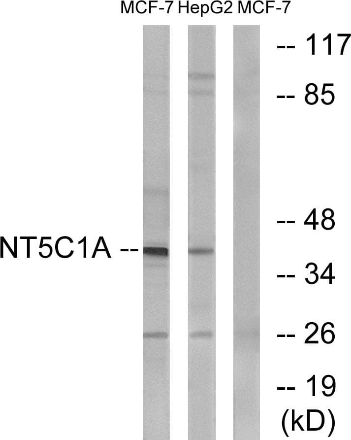 NT5C1A / CN1A Antibody