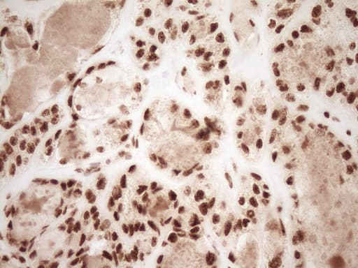 NUDT21 Antibody (aa2-227, clone OTI5B3)